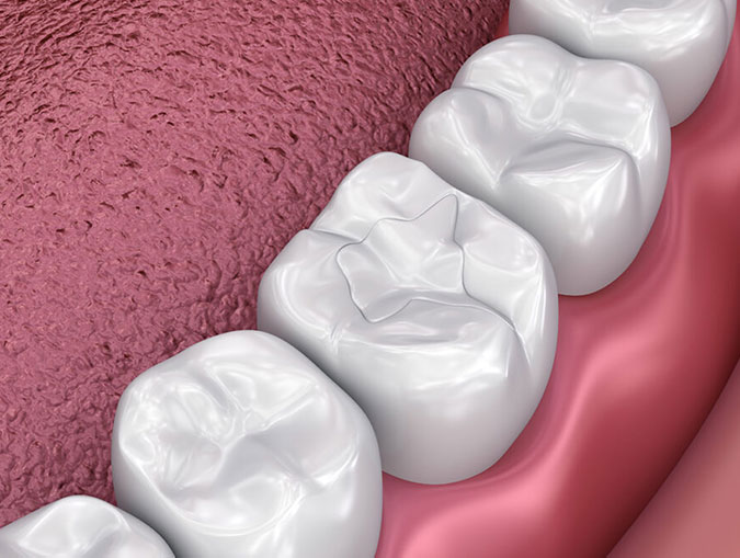 Dental Restoration and Cosmetic Dentistry